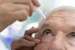 Understanding Cataract