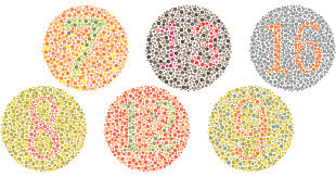 Understanding color vision deficiency (CVD): types like Protanopia, Deuteranopia, and clinical diagnostic methods at Hirocon.